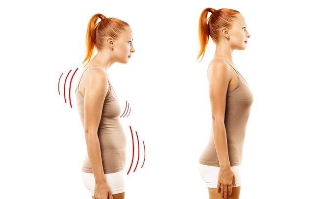 aligning as a reason for the development of lumbar osteochondrosis