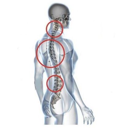 places of spinal osteochondrosis