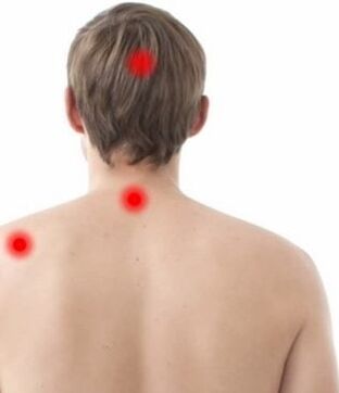 site of pain in cervical osteochondrosis