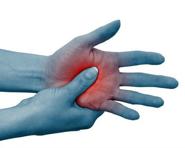 Severe pain in the joints of the fingers, decreasing with physical exertion, is a typical sign of rheumatoid arthritis.